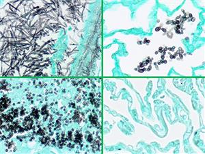 4235B | Control Slides:Histopathology; Fungus, GMS, Multi Tissue, Artificial